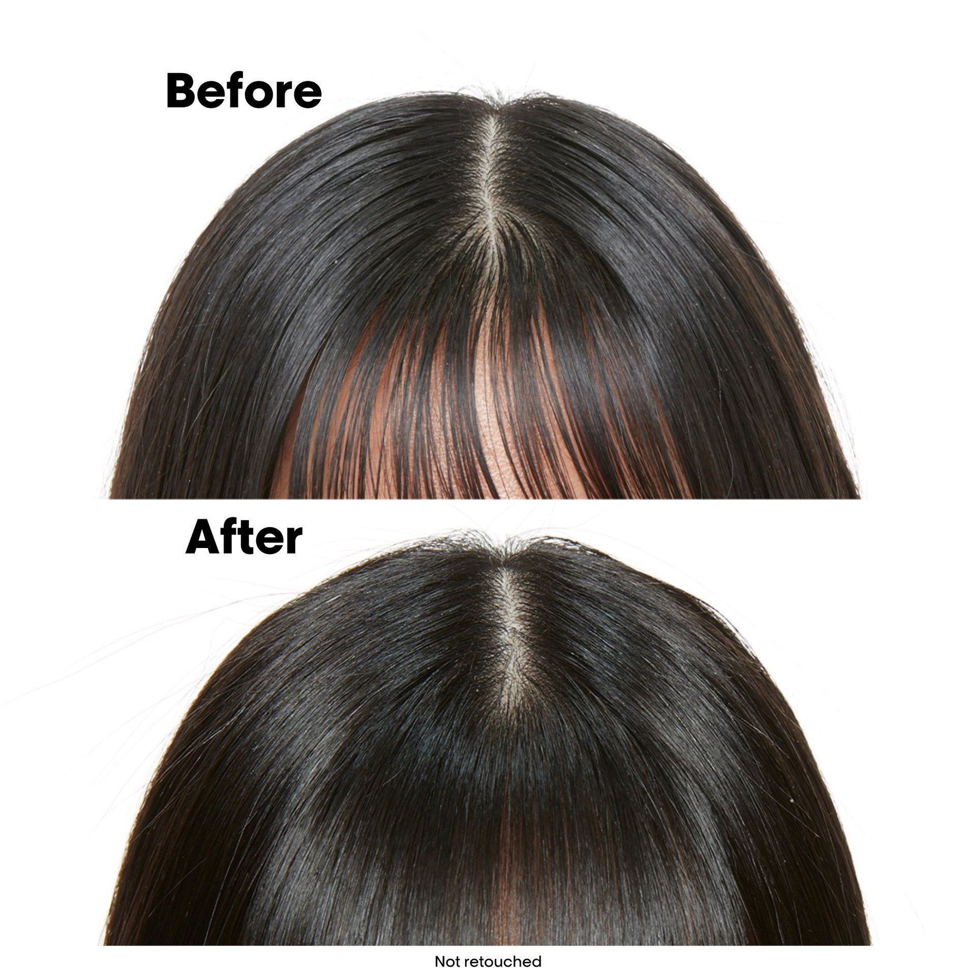 A Before and After Shot of a model with oily hair. 
