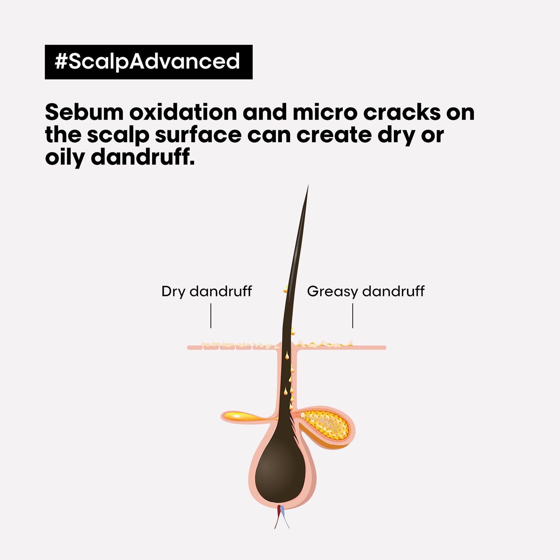 scalp-advanced-anti-discomfort-dermo-regulator-shampoo7