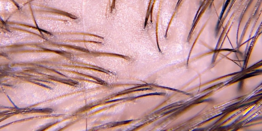 Focus on an oily scalp, showing how to stop greasy hair, where it can come from, and tips for maintaining fresh, healthy hair.